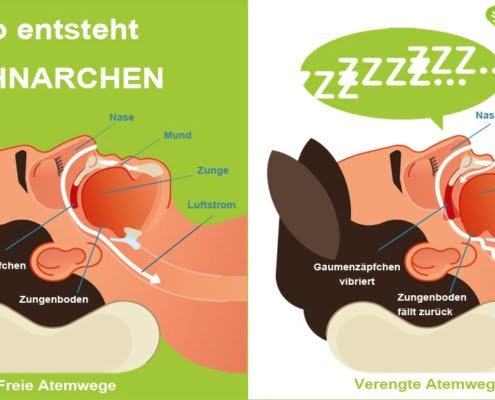 Wie ensteht Schnarchen